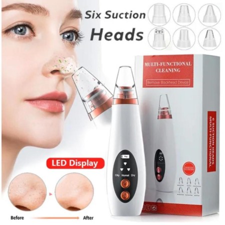 Multifunctional Blackhead Remover
