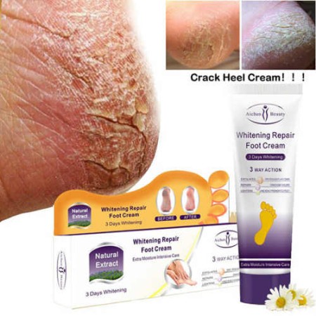 Whitening repair foot cream